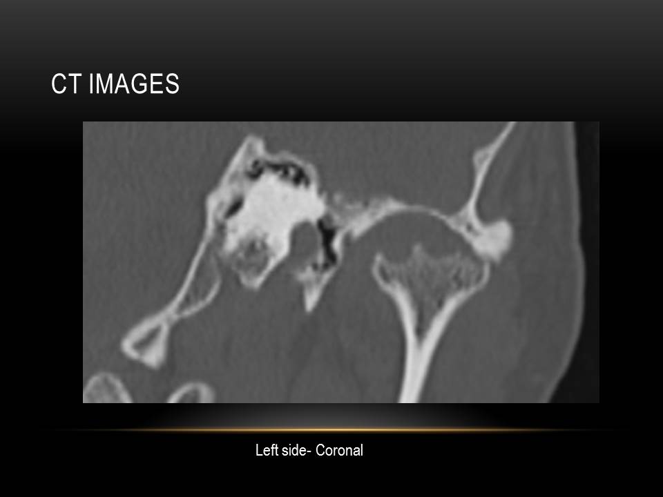 Assessment of TMJ issues via Imaging