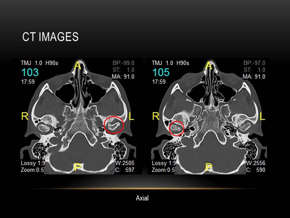 Assessment of TMJ issues via Imaging